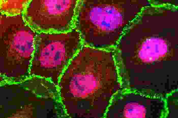 A close up to a group of cells with a green outline, each one has a blue and pink center