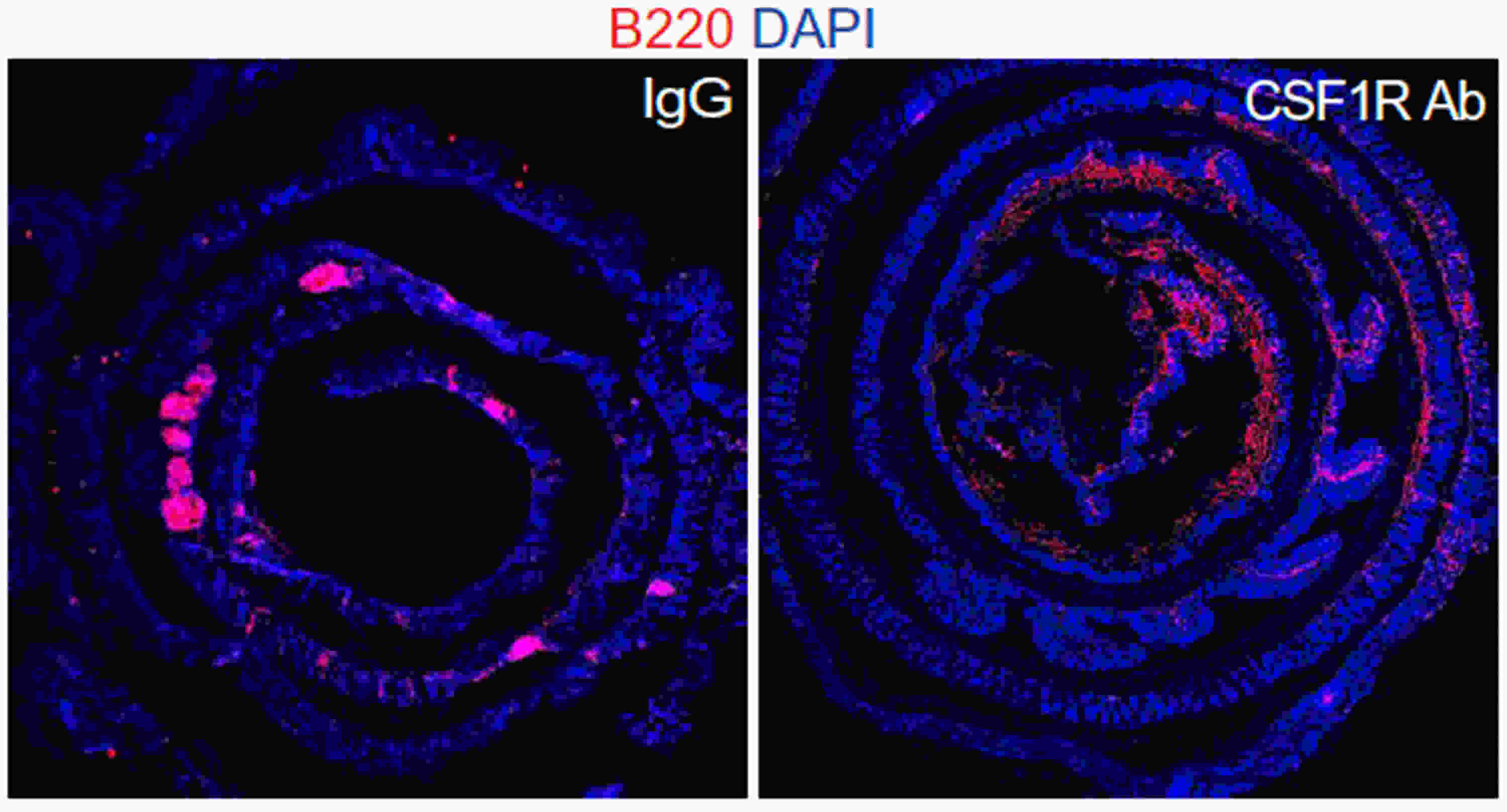 Tertiary Lymphoid Structures (TLS) in Mice Colon