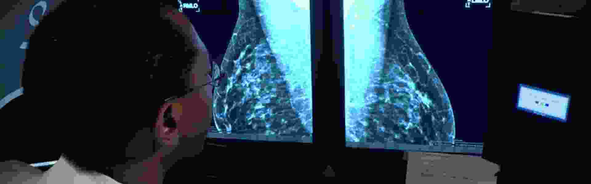 breast-cancer.jpg