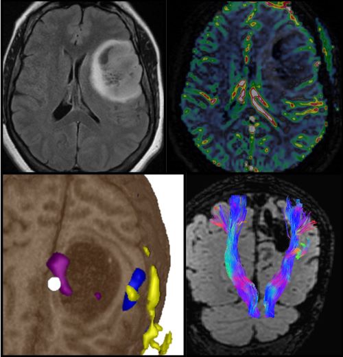 Neuroradiology →