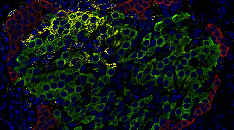 rna-situ-hybridization