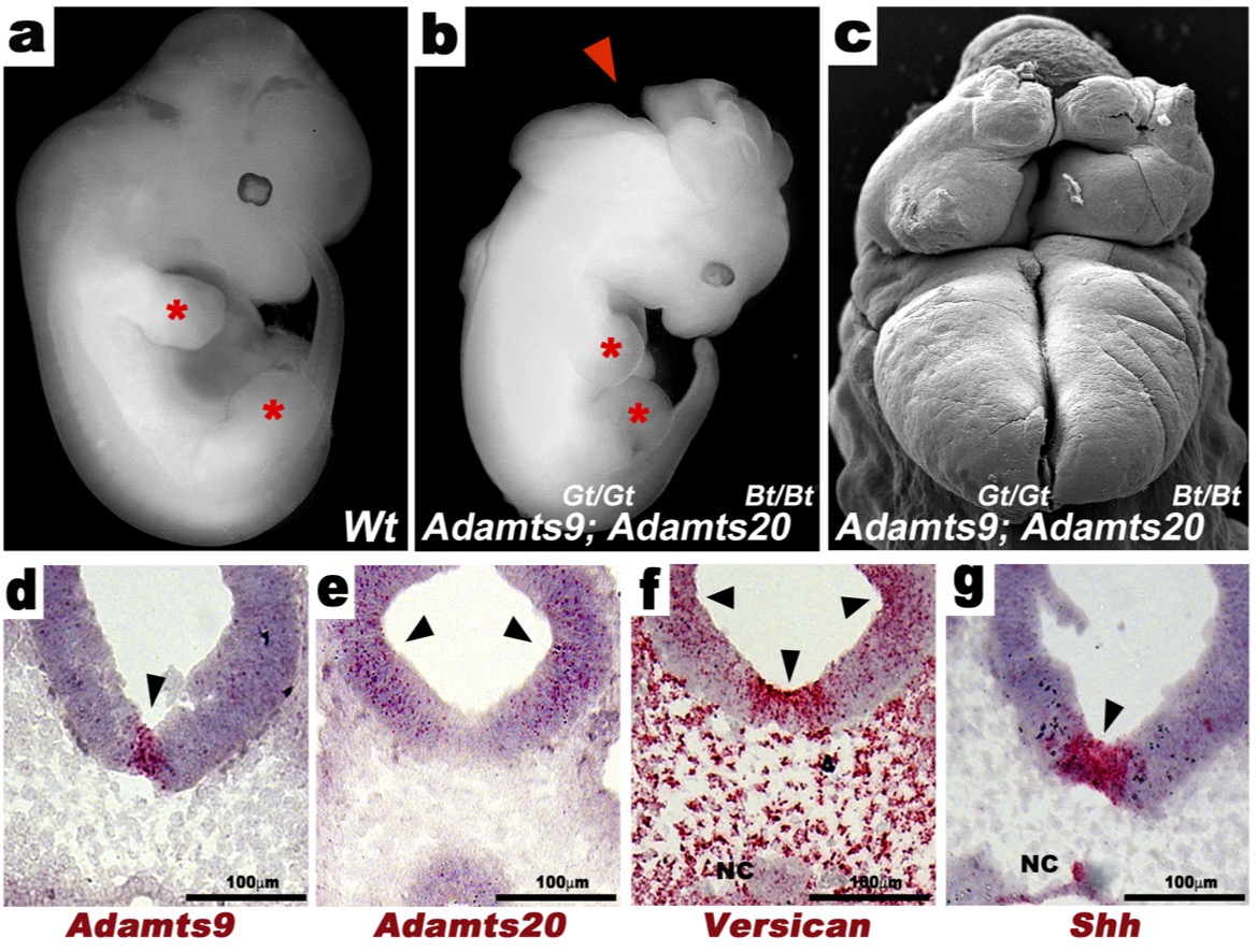 Neural Tube1