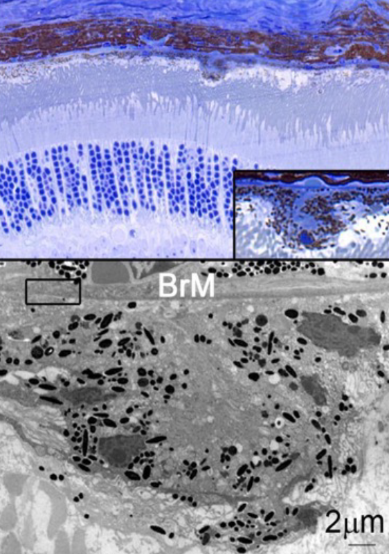 Subretinal Deposit in Mouse