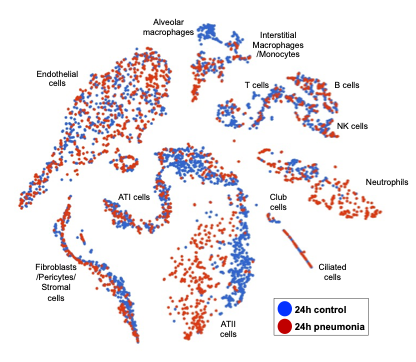 PneumLungModel