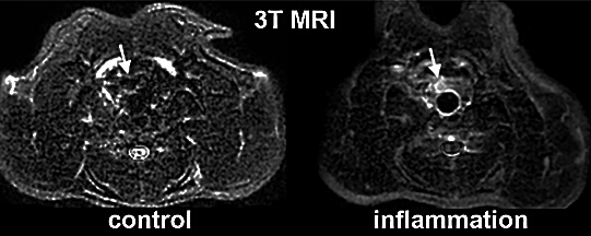 Control and inflamed model aneurysms imaged using 3T MRI after the administration of an MPO-specific imaging probe