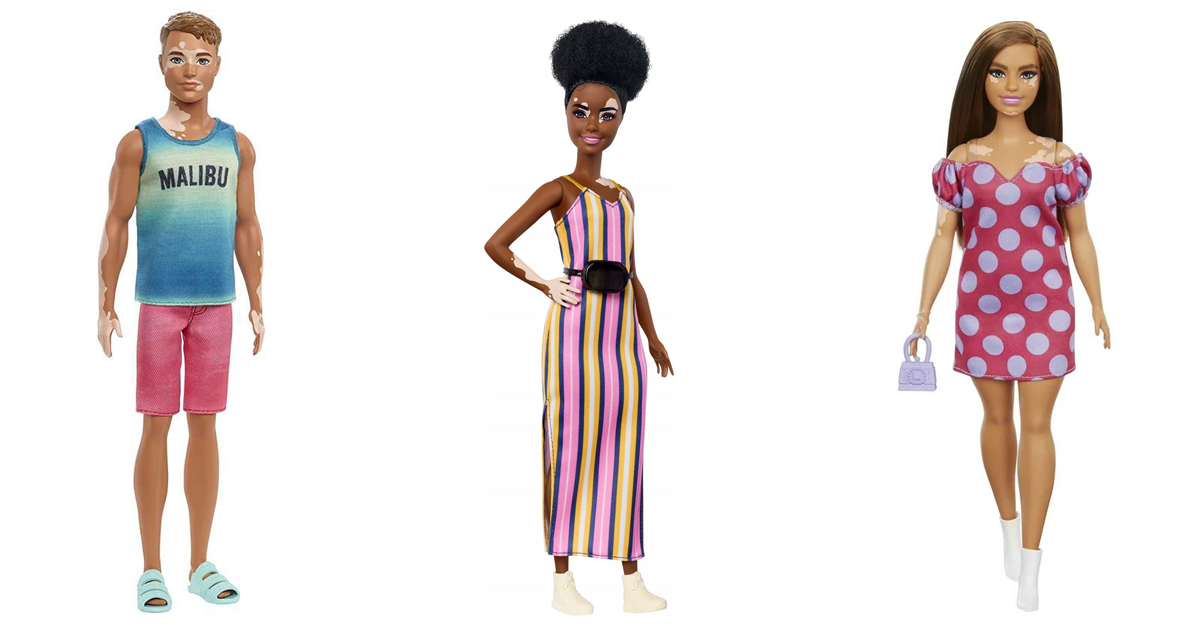 image of two barbie dolls and a ken doll with vitiligo