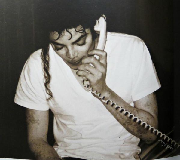 Michael Jackson vitiligo