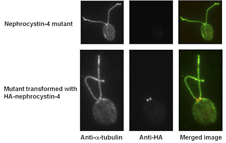 Nephrocystin-4